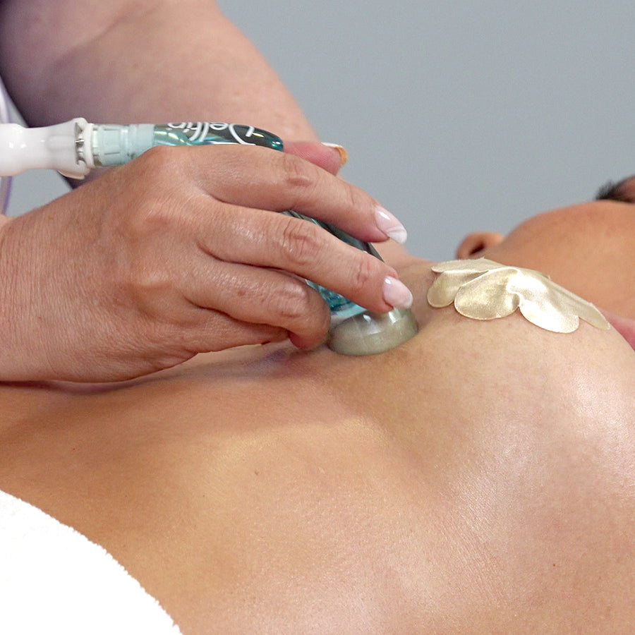 Copa Facial y Localizada Delfín: Lifting facial y Drenaje de Precisión.